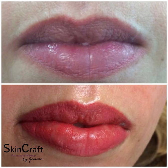 PERMANENT LIPS | Skincraft