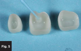 coating the internal surface of a monolithic zirconia crown with a primer