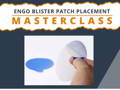 ENGO Blister Patch Placement Masterclass