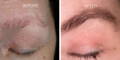 Nulastin Lash Serum Results Before After