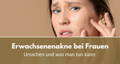 erwachsenenakne bei frauen ursachen und was man tun kann