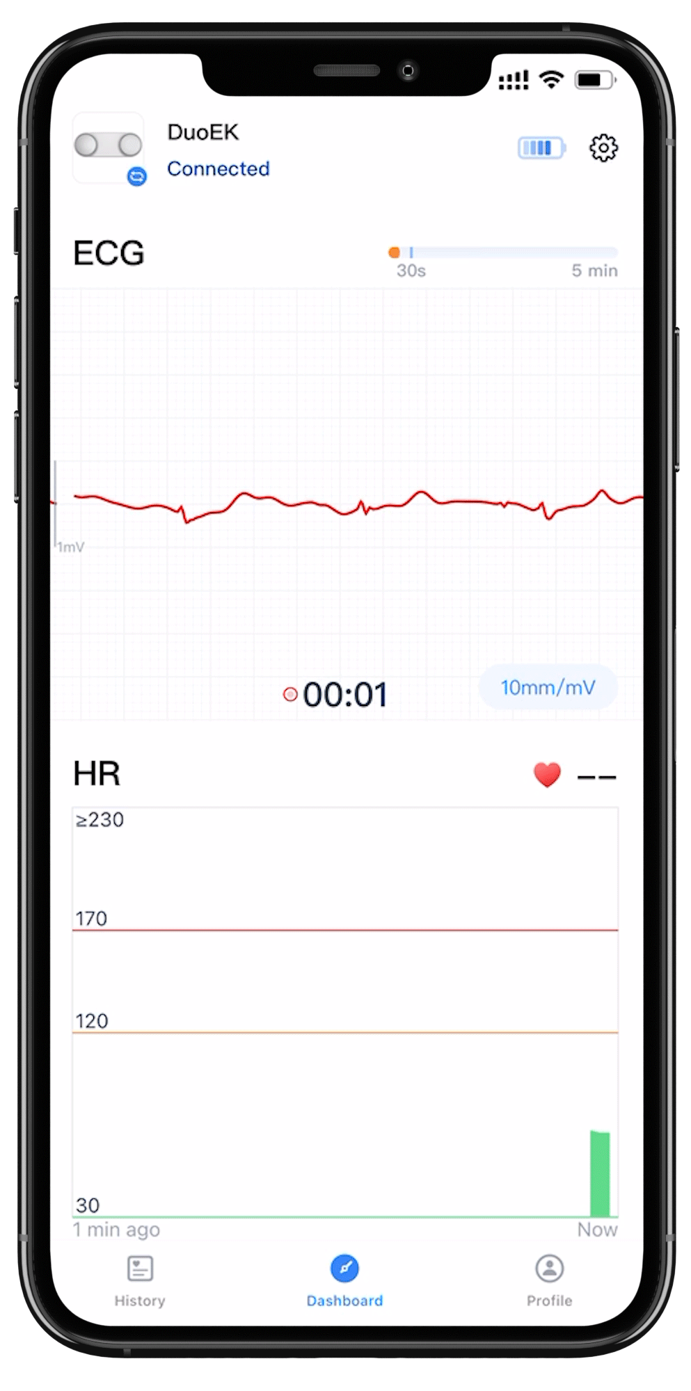 Wellue tragbarer Echtzeit-EKG-Monitor