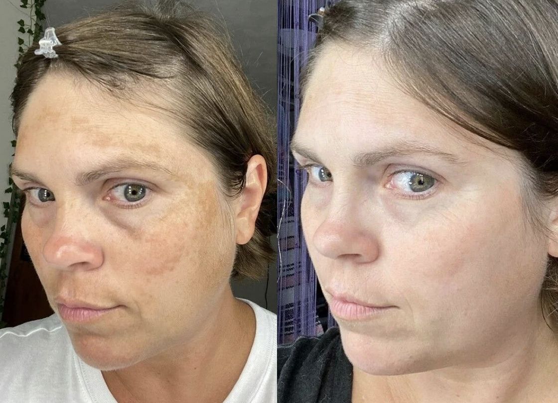 Jeannette P. before and after