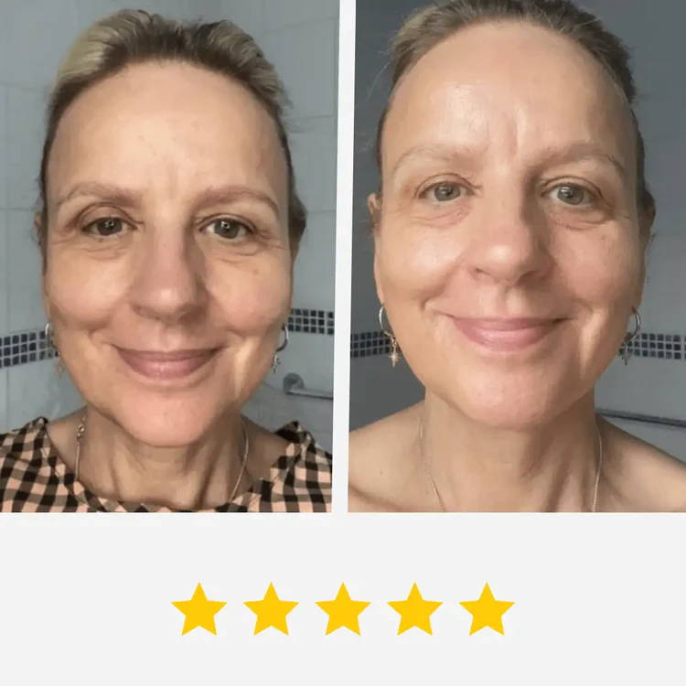 Olavita™ Botox Serum Special Offer