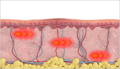 Thermal Diffusion Treatment