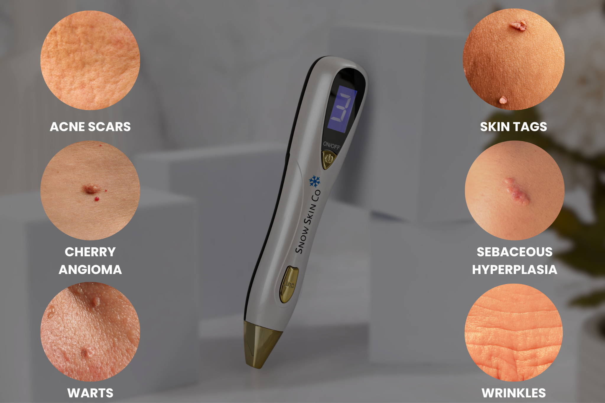 Best fibroblast plasma pen to buy, plasma pen for sale, plasma pen, fibroblast plasma pen, buy plasma pen, 