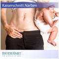 Kaiserschnittnarben