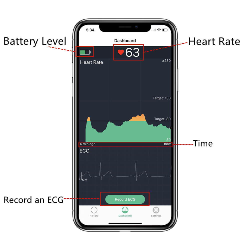 Kardia mobile ekg, alivecor kardiamobile ekg monitor,