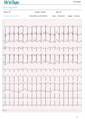 مراجعة شكل الموجة ECG