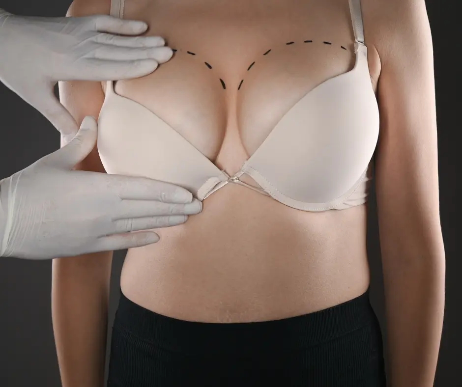 Breast Plastic Surgery in dubai