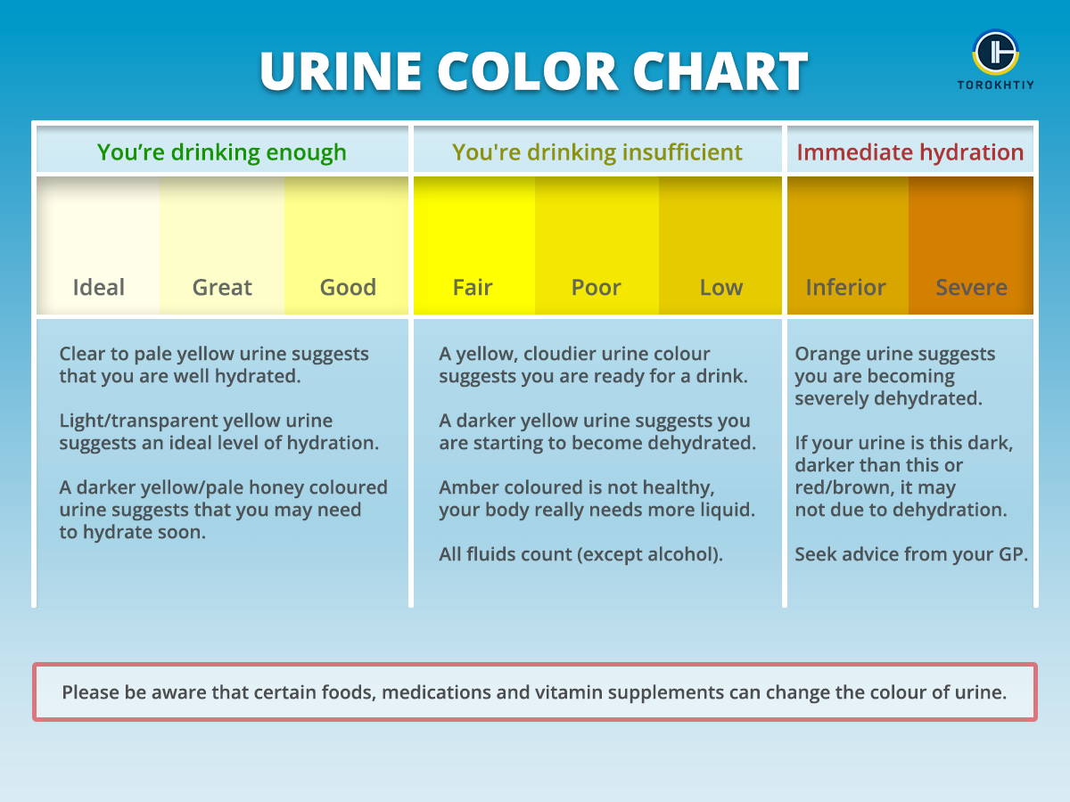 Color Urine Chart