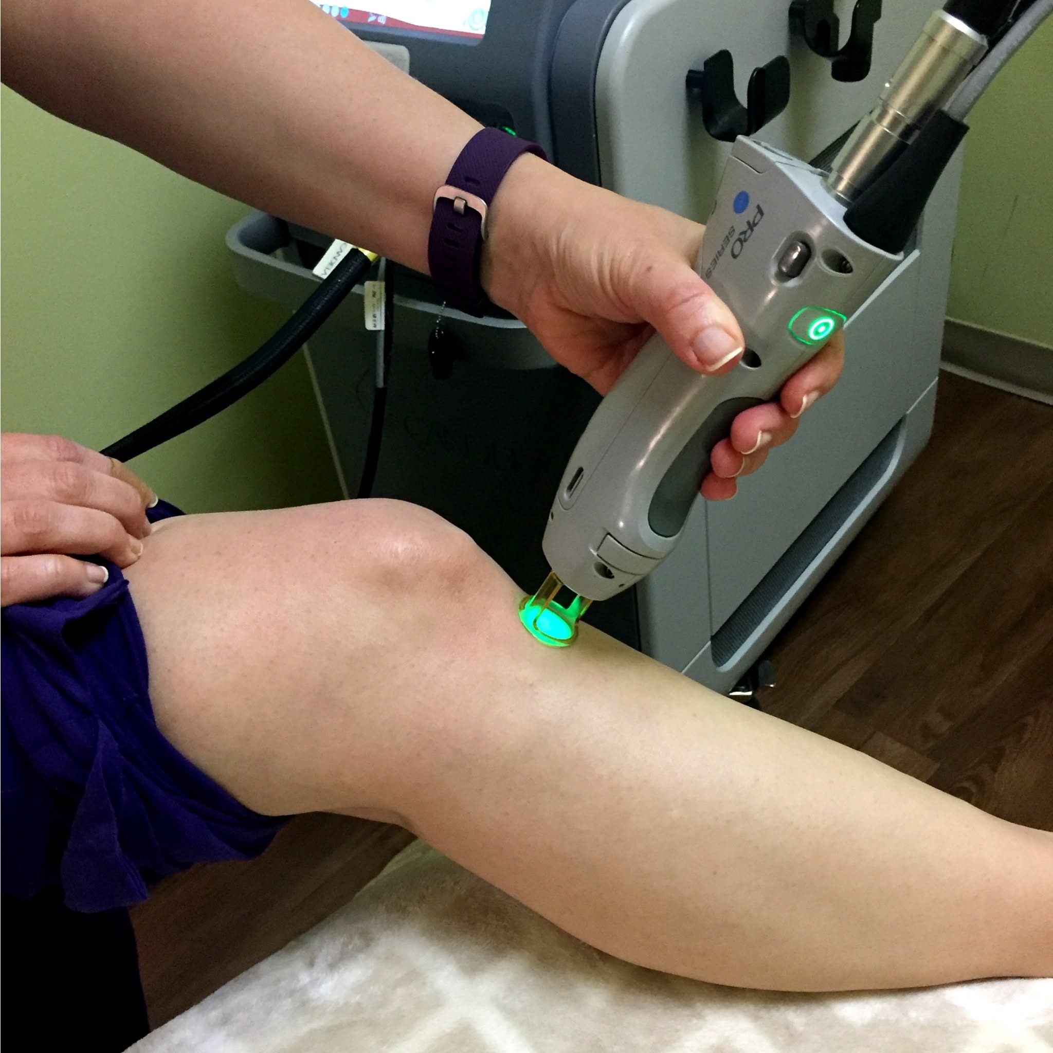 Laser Treatments