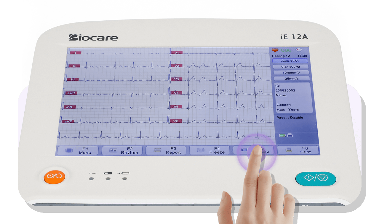 Biocare iE12A タッチスクリーン付き 12 チャンネル ECG マシンにより、迅速な操作が可能
