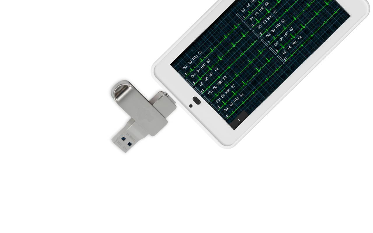 Das Taschen-EKG-Gerät von Wellue mit 12 Ableitungen bietet ein USB-Typ-C-Falsh-Laufwerk zum Speichern und Drucken von Daten