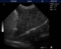 VU10 獣医用超音波犬肝臓スキャン画像