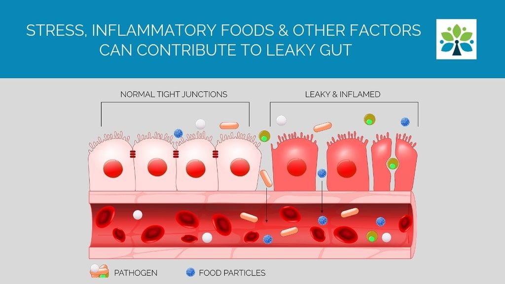 Your Guide on How to Use Probiotics for Leaky Gut