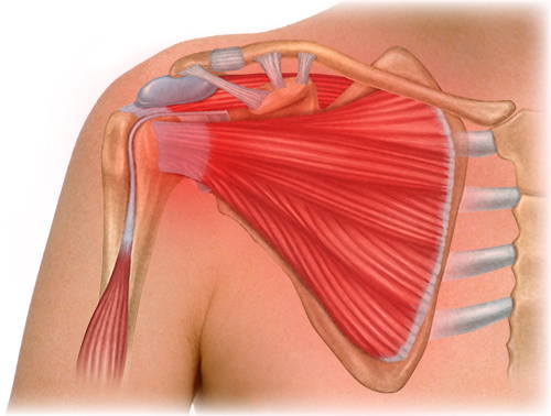 Post-Operative Discomfort Illustration