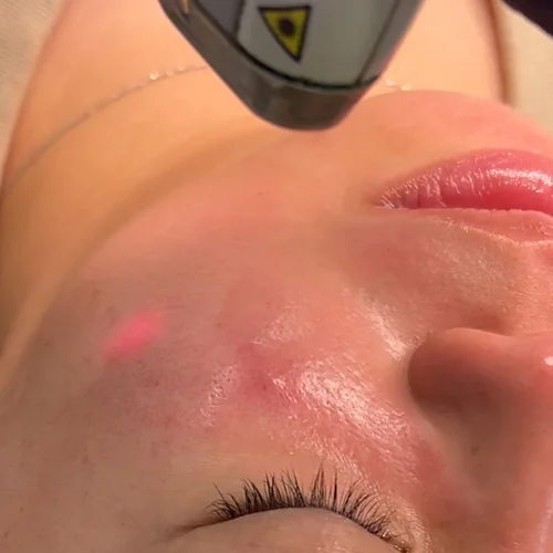 Haus of Dermal Voucher - Image 8