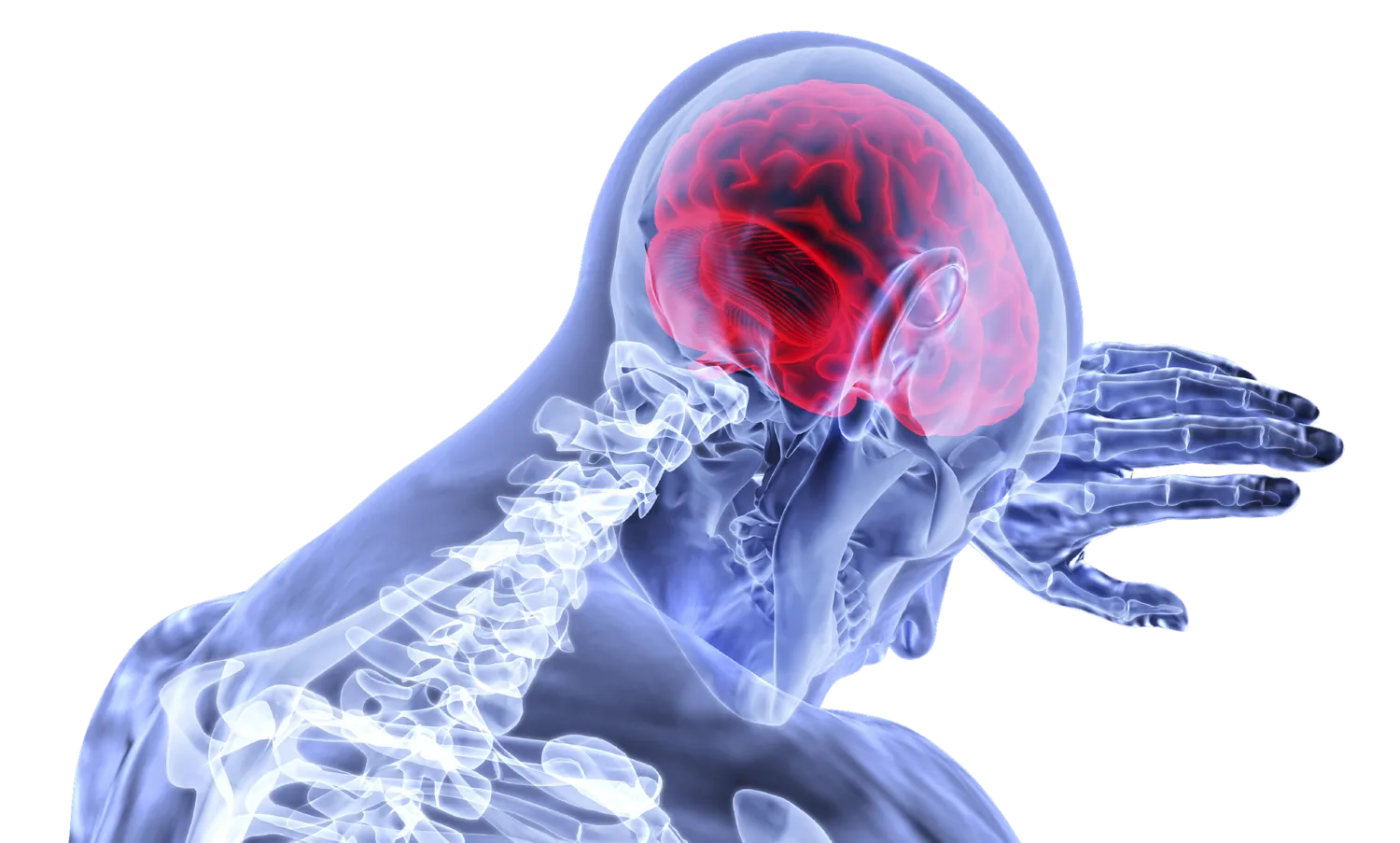 Concussion