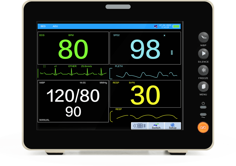 fetal monitor with CTG scoring system