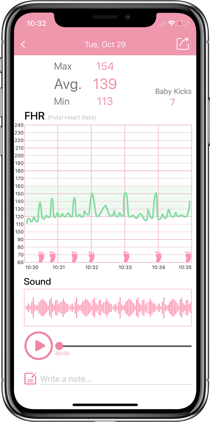 Portable Fetal Heartbeat Doppler Monitor For Home Use - Pregnancy Accessory (Model K4)