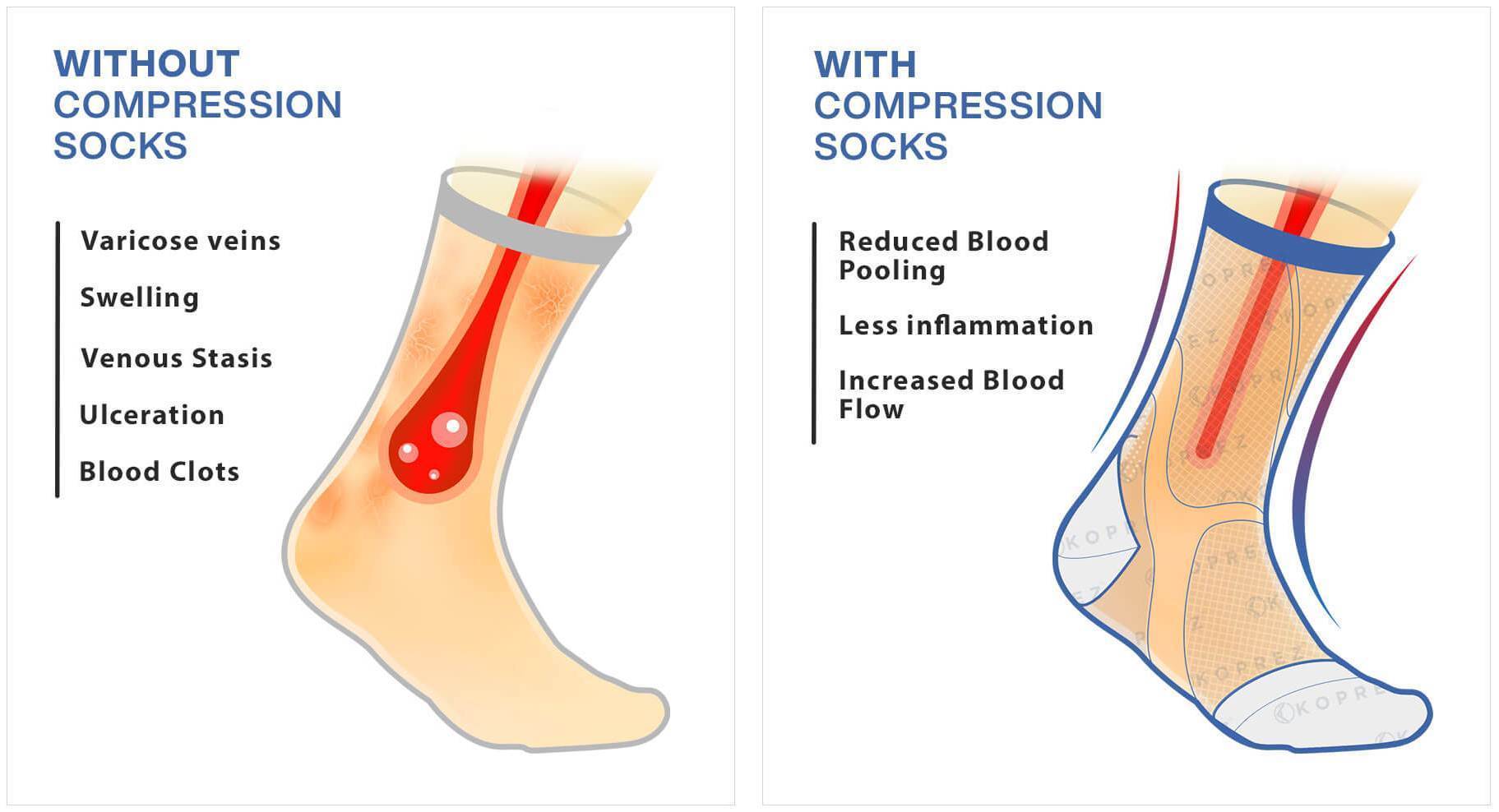 Compression Socks vs Stockings: Which Is Right For You? - Koprez®