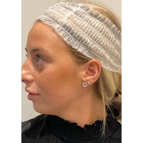 NON-SURGICAL FACE & NECK LIFT BEFORE