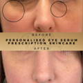 Personalised Eye Serum Skincare Dr Sknn Before & After Picture