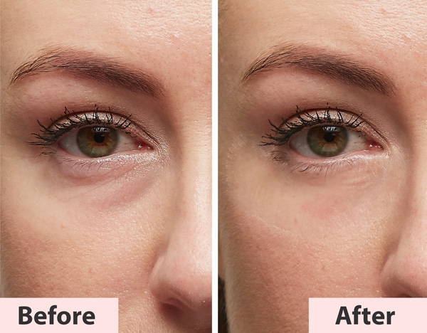 best under eye cream for wrinkles