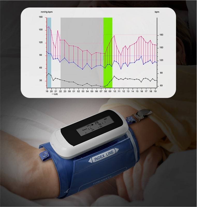 ABPM monitor tracks blood pressure 24/7 and indicates the whole day's blood pressure fluctuation.