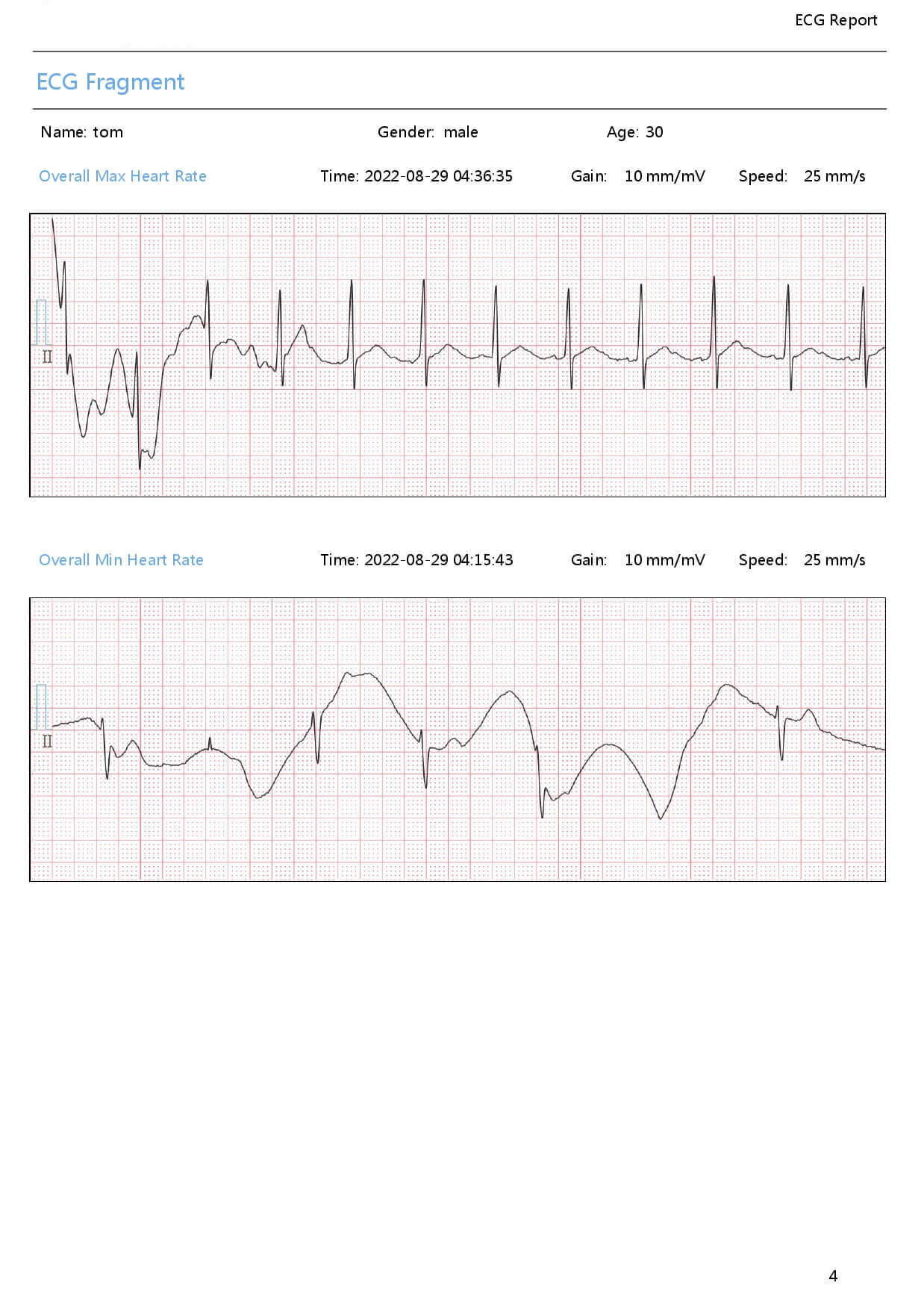 record ecg/ekg strips heart rhythm with mdcubes heart monitor