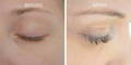 Nulastin Lash Serum Results Before After