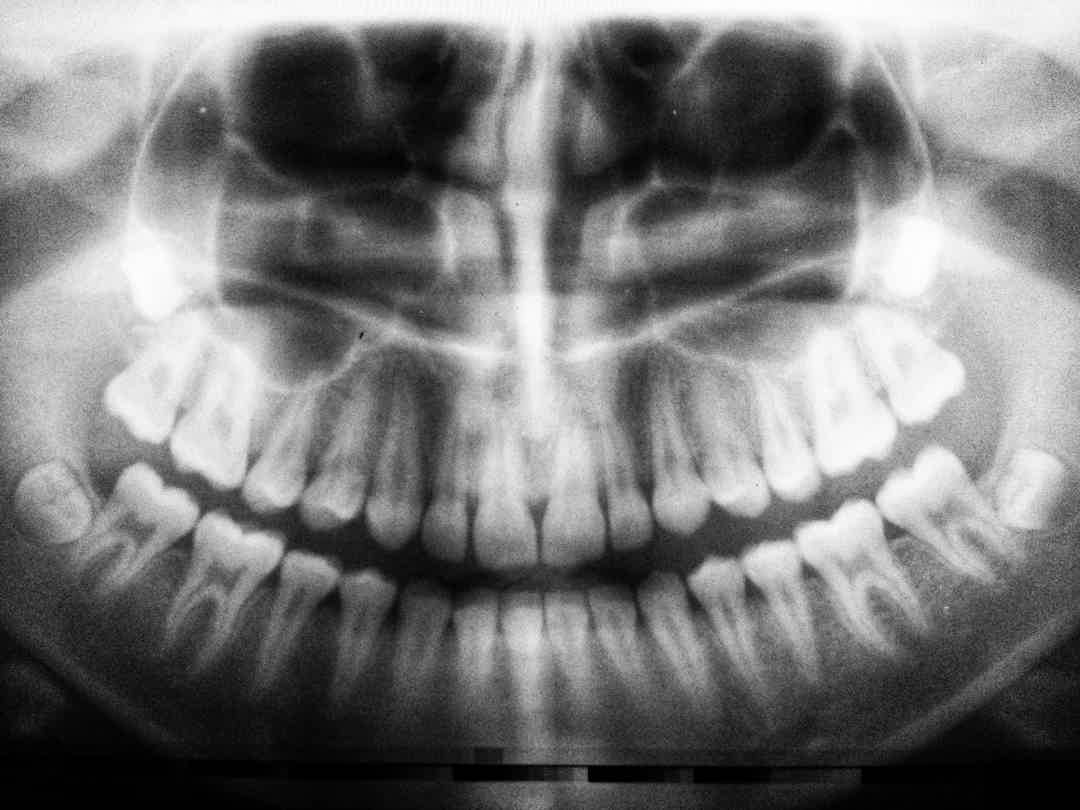 The Connection Between Teeth and Energy Meridians