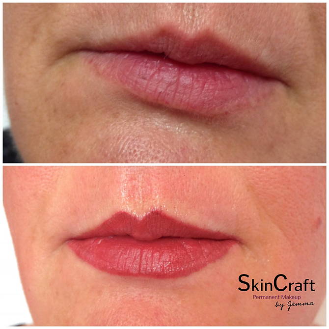 PERMANENT LIPS | Skincraft
