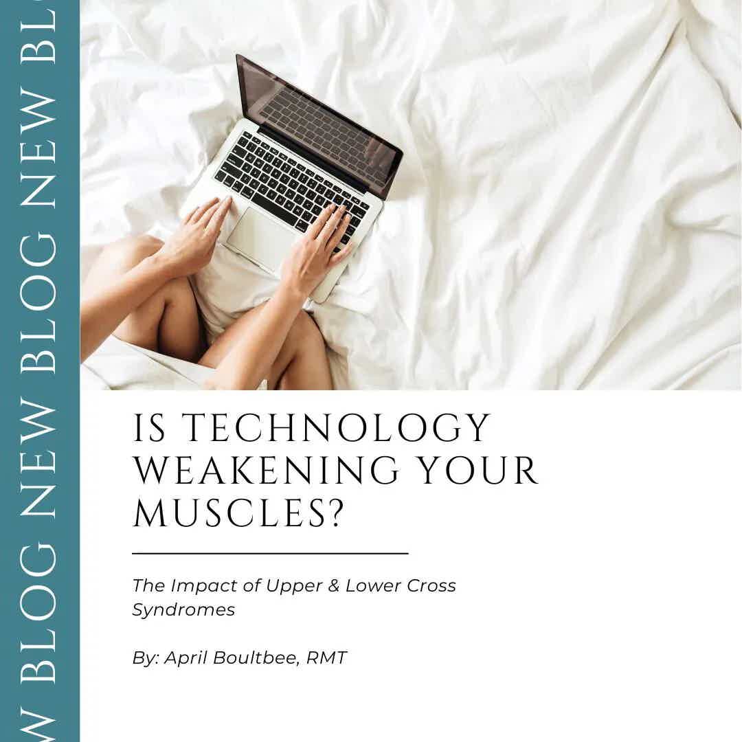 Is Tech Weakening Your Muscles? The Impact of Upper and Lower Cross Syndromes