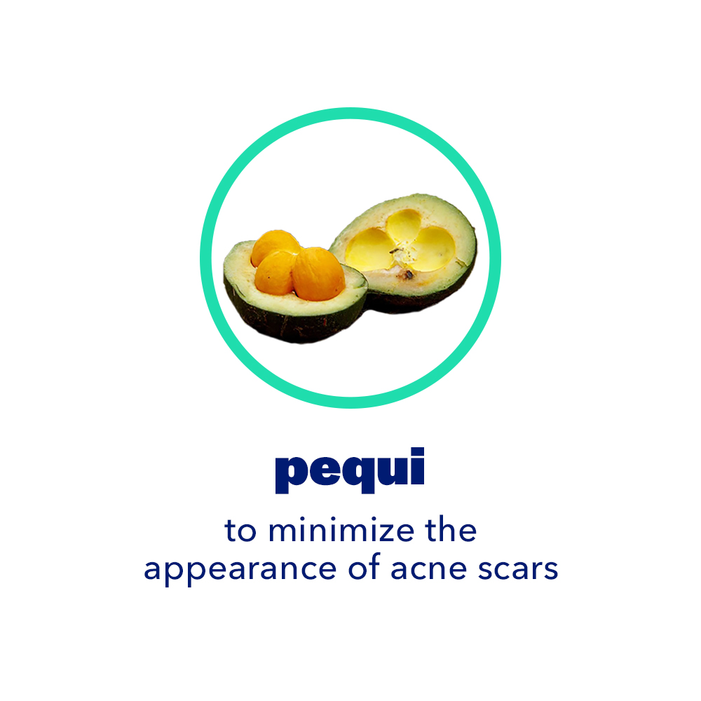 Pequi