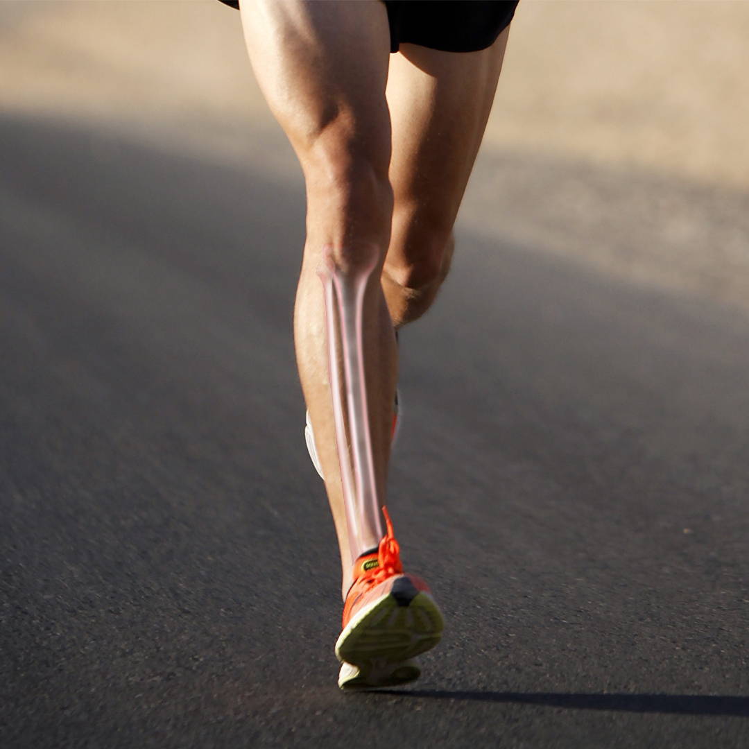 Runner with an x-ray style view of the tibia