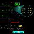 Wellue patient monitor with ST-segment analysis