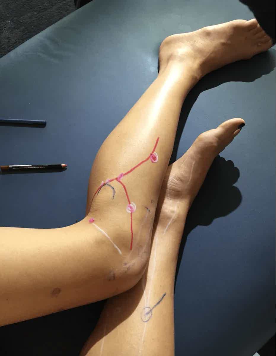 Healing Injuries