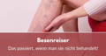 Besenreiser nicht behandeln