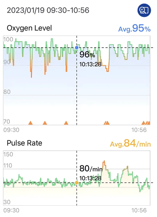 SleepU app high resolution charts for oxygen level, pulse rate, and oxygen drop patterns