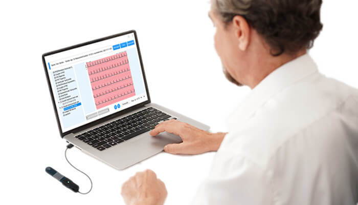 detecte latidos cardíacos irregulares (arritmias) con el registrador de ECG de 24 horas de Wellue con análisis de IA
