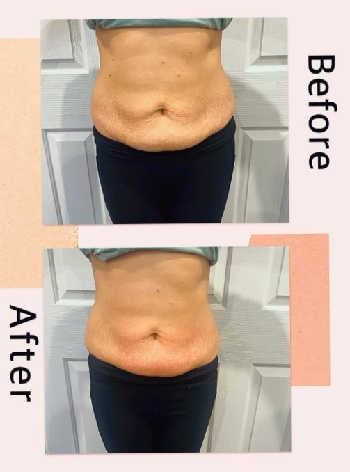 Tone 2 Glow - Image 4