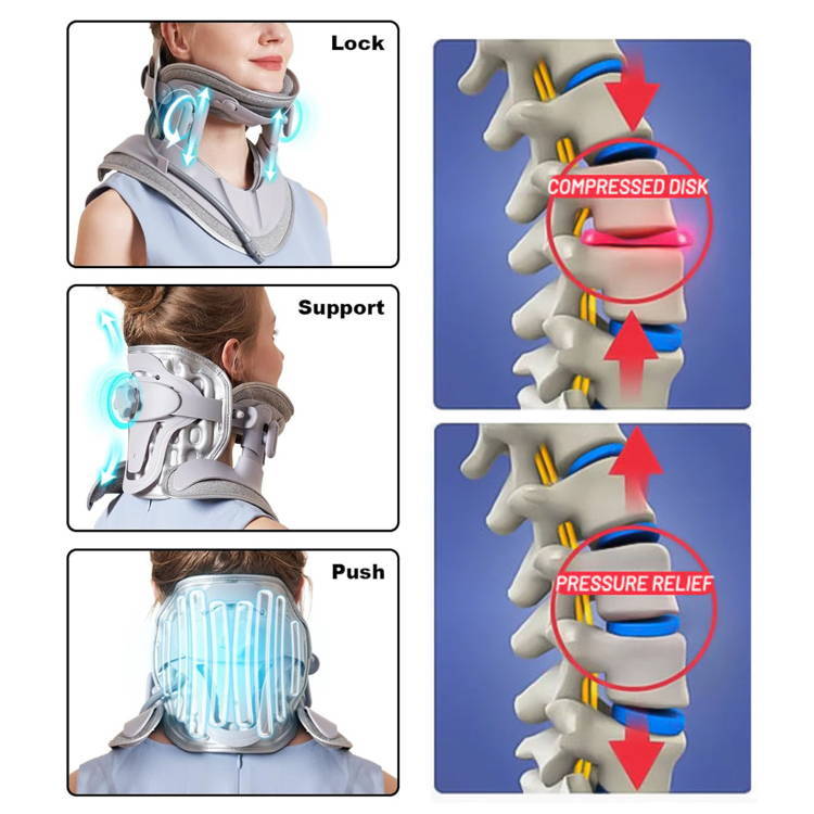 Neck Brace which Decompresses the Neck and Relieves Neck Tension