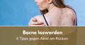 Bacne Pickel am Rücken loswerden