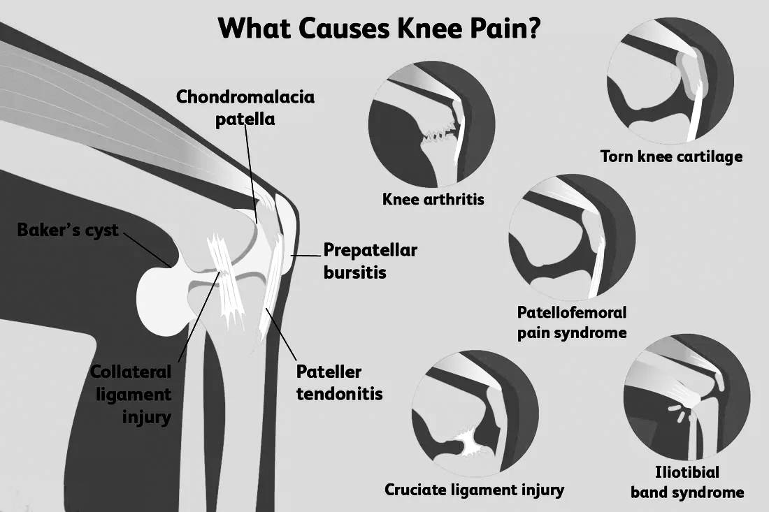 anteromedial knee pain ,  what causes pain in the back of the knee ,  sciatica symptoms ,  sharp stabbing pain in knee comes and goes ,  pain on outside of knee when bending and straightening ,  va disability calculator ,  what is gout in the knee ,  my knee hurts when i bend it and straighten it ,  top of knee pain when bending ,  cbd for knee pain ,  pain behind knee cap ,  glucosamine for knee pain ,  bakers cyst ,  back of knee pain when bending ,  patellar tendonitis treatment ,  how to get rid of knee pain fast ,  hamstring pain behind knee ,  jumpers knee ,  meniscus tear symptoms ,  chondromalacia patella ,  best cbd for knee pain ,  can sciatica cause knee pain ,  patellar tendon ,  types of knee pain ,  mcl pain location ,  knee pain exercises ,  knee pain when bending ,  how to get rid of knee pain fast ,  knee pain treatment at home ,  knee pain in ladies ,  types of knee pain ,  knee pain reasons ,  knee pain symptom checker ,  knee pain when bending ,  knee pain exercises ,  knee pain treatment at home ,  knee pain in ladies ,  knee pain reasons ,  knee pain causes in young adults ,  back of knee pain ,  side of knee pain ,  knee pain when bending ,  knee pain relief ,  knee pain exercises ,  exercises for knee pain ,  knee cap pain ,  inner knee pain ,  knee stretches for pain ,  knee pain when squatting ,  stretches for knee pain ,  knee joint pain ,  what is the best painkiller for knee pain ,  how to get rid of knee pain fast ,  lateral knee pain ,  knee pain after running ,  knee pain treatment at home ,  knee pain on inside of knee ,  back of knee pain when straightening leg ,  knee pain in ladies ,  knee pain symptom checker ,  knee cap for knee pain ,  best heating pad for neck and shoulder pain ,  exercises for neck and shoulder pain ,  rheumatoid arthritis ,  shoulder brace ,  shoulder pain from lifting ,  kt tape for shoulder pain ,  shoulder impingement treatment ,  shoulder pain that radiates down arm ,  stabbing pain under left shoulder blade ,  frozen shoulder symptoms ,  right shoulder pain heart attack ,  stabbing pain under right shoulder blade ,  posterior shoulder pain ,  shoulder pain when raising arm ,  signs of heart attack ,  fibromyalgia ,  herniated disc ,  right shoulder pain ,  shoulder pain exercises ,  shoulder pain when lifting arm ,  right shoulder pain in women ,  shoulder pain treatment ,  causes of shoulder pain in female ,  shoulder pain left side ,  shoulder pain reasons ,  right shoulder pain ,  shoulder pain when lifting arm ,  shoulder pain treatment ,  causes of shoulder pain in female ,  shoulder pain left side ,  shoulder pain reasons ,  shoulder blade pain ,  left shoulder pain ,  shoulder and neck pain ,  neck and shoulder pain ,  shoulder pain diagnosis chart ,  right shoulder pain ,  front shoulder pain ,  shoulder back pain ,  shoulder pain relief ,  shoulder pain exercises ,  back shoulder pain ,  shoulder joint pain ,  shoulder pain from sleeping ,  shoulder blade pain left side ,  shoulder and neck pain on right side ,  shoulder and neck pain on left side ,  shoulder and left arm pain ,  shoulder pain when lifting arm ,  neck and shoulder pain on left side ,  neck and shoulder pain on right side ,  left arm and shoulder pain ,  shoulder blade pain right side ,  shoulder blade pain left side woman ,  causes of shoulder pain in female ,  shoulder pain left side ,  shoulder pain relief exercises ,  shoulder pain cancer ,  shoulder pain after workout ,  shoulder pain treatment at home ,  sudden shoulder pain without injury , knee pain massager , knee massager with heat, knee massager machine, compression knee massager, best knee massager, heated knee massager, knee massager amazon, knee massager for pain relief, sharper image knee massager, knee massager walmart, electric knee massager, knee pain massager machine, hailicare knee massager, compression knee massager reviews, knee and leg massager, knee compression massager, knee and foot massager, knee brace massager, knee massager machine for arthritis, knee massager argos, knee massager uk, kneeflow massager review, knee pain massager machine price in india, knee electric massager, knee massager for arthritis, best knee massager for arthritis, hailicare heated knee massager, bionic compression knee massager, kneeflow massager, compression knee massager, compression knee massager reviews, knee massager reviews, do knee massagers work, best knee massager machine, hezheng knee massager, compression knee massager, compression knee massager reviews, best knee massager 2020, knee massager reviews, best knee massager machine, shiatsu knee massager, air compression knee massager, hezheng knee massager,