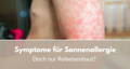 symptome für sonnenallergie