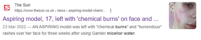 Can Micellar Water Burn Skin