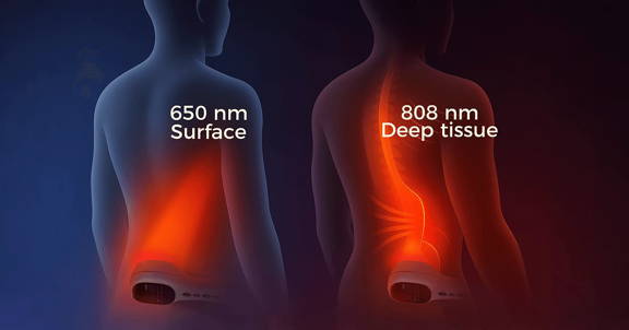 Cold laser therapy wavelengths 650nm and 808nm for sciatica and arthritis deep pain relief