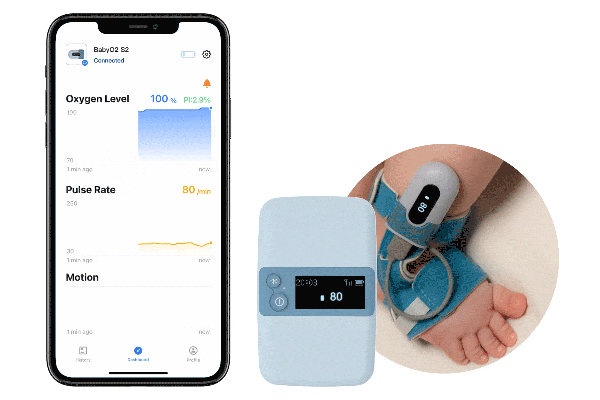 baby sleep monitor per la cura del bambino